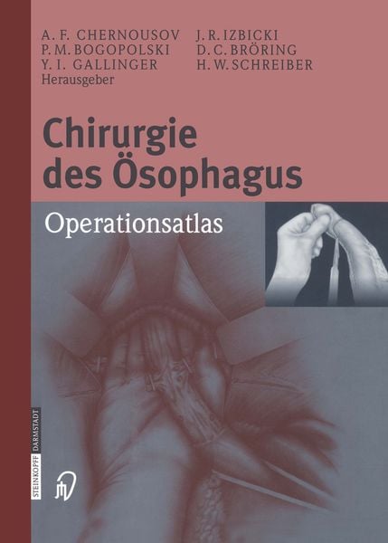 Produktbild: Chirurgie des &Ouml;sophagus