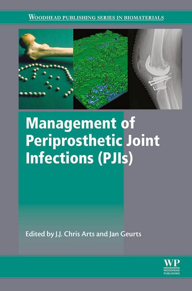 Produktbild: Management of Periprosthetic Joint Infections (PJIs)