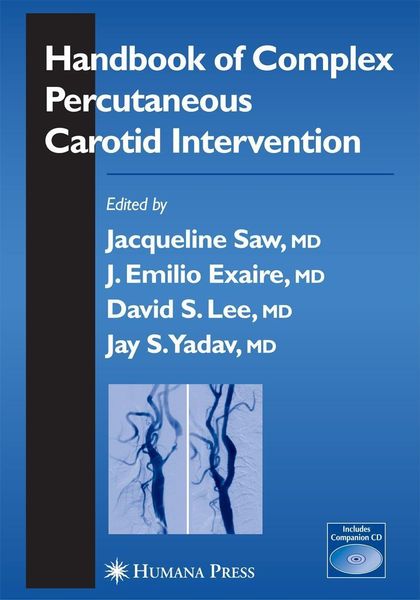 Produktbild: Handbook of Complex Percutaneous Carotid Intervention