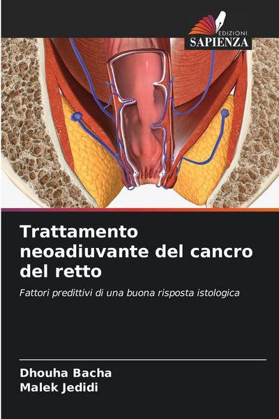 Produktbild: Trattamento neoadiuvante del cancro del retto
