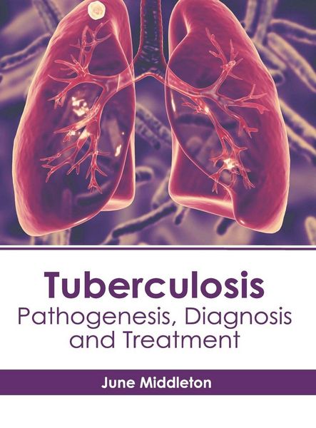Produktbild: Tuberculosis: Pathogenesis, Diagnosis and Treatment
