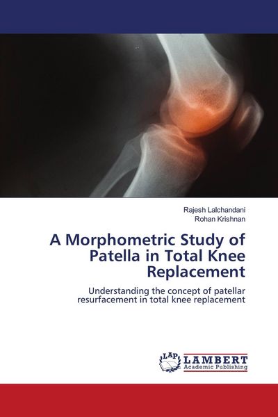 Produktbild: A Morphometric Study of Patella in Total Knee Replacement
