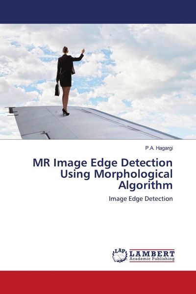 Produktbild: MR Image Edge Detection Using Morphological Algorithm