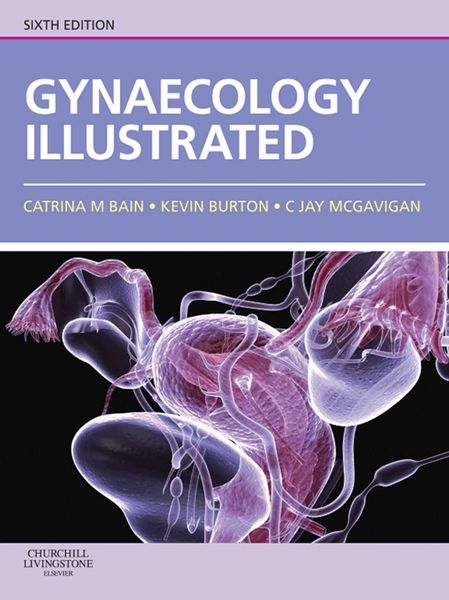Produktbild: Gynaecology Illustrated E-Book