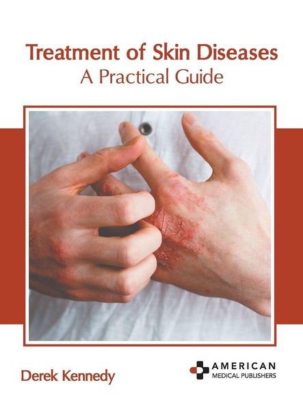 Produktbild: Treatment of Skin Diseases: A Practical Guide