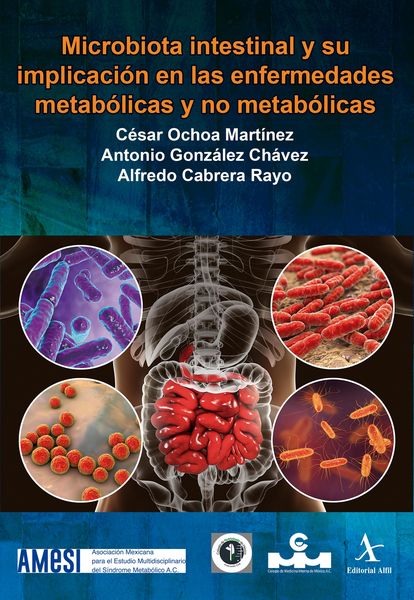 Produktbild: Microbiota intestinal y su implicaci&oacute;n en las enfermedades metab&oacute;licas y no metab&oacute;licas
