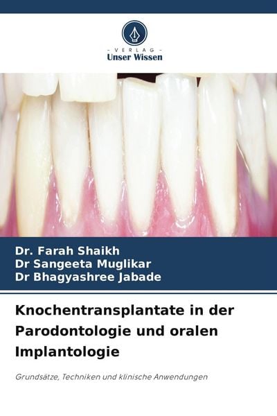 Produktbild: Knochentransplantate in der Parodontologie und oralen Implantologie