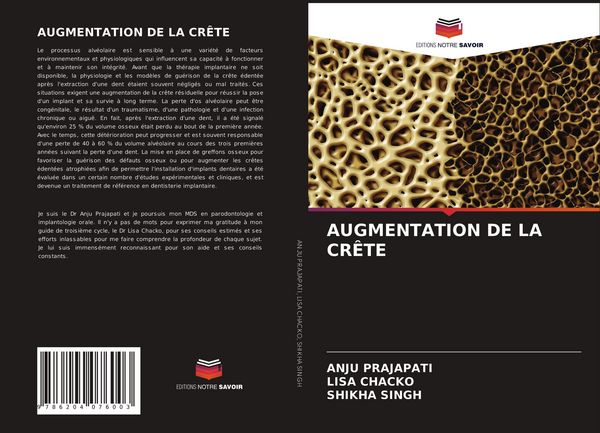 Produktbild: Augmentation De La Cr&ecirc;te