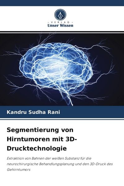 Segmentierung von Hirntumoren mit 3D-Drucktechnologie, Taschenbuch von Kandru Sudha Rani, Verlag Unser Wissen, 9786204059440