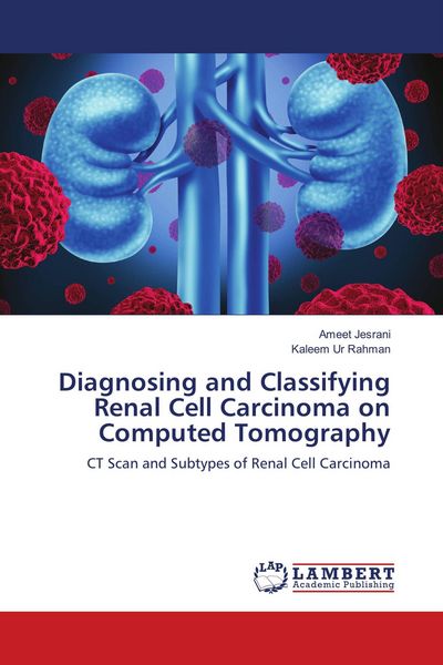 Produktbild: Diagnosing and Classifying Renal Cell Carcinoma on Computed Tomography