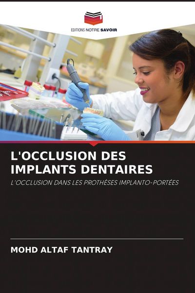 Produktbild: L'occlusion des Implants Dentaires