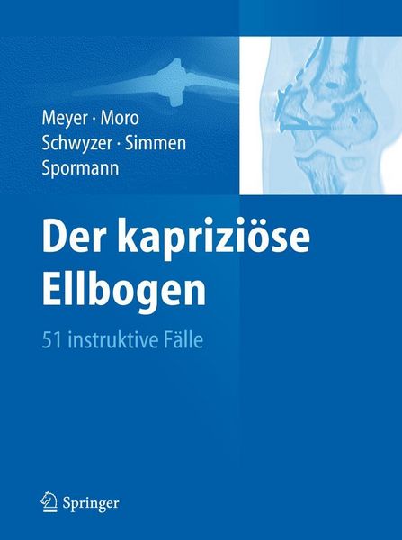 Produktbild: Der kaprizi&ouml;se Ellbogen