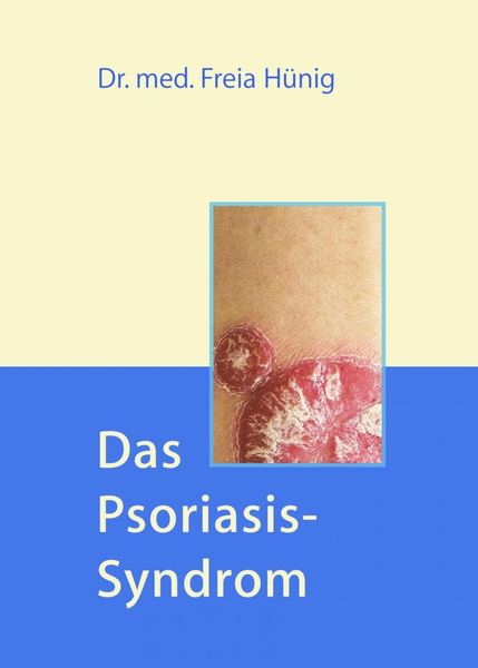 Produktbild: Das Psoriasis-Syndrom