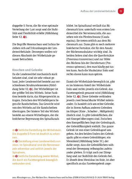 Produktbild: Der R&uuml;cken-Doc: Hexenschuss und Ischias