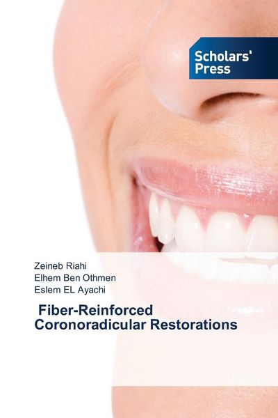 Produktbild: &iquest; Fiber-Reinforced Coronoradicular Restorations