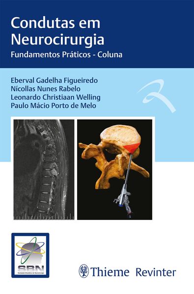 Produktbild: Condutas em Neurocirurgia