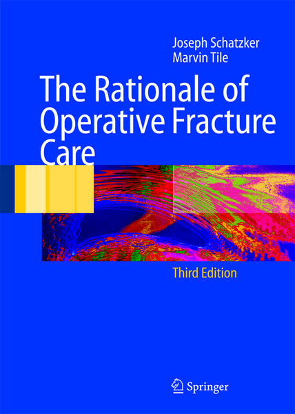 Produktbild: The Rationale of Operative Fracture Care