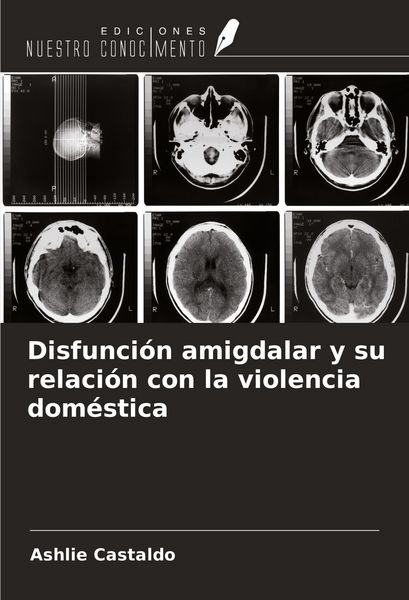 Produktbild: Disfunci&oacute;n amigdalar y su relaci&oacute;n con la violencia dom&eacute;stica