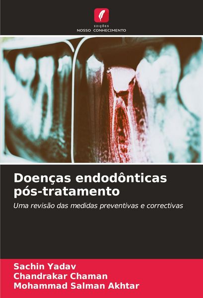 Produktbild: Doen&ccedil;as endod&ocirc;nticas p&oacute;s-tratamento