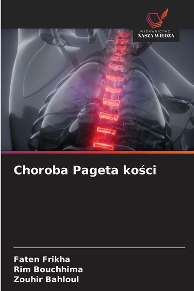 Produktbild: Choroba Pageta ko&iquest;ci