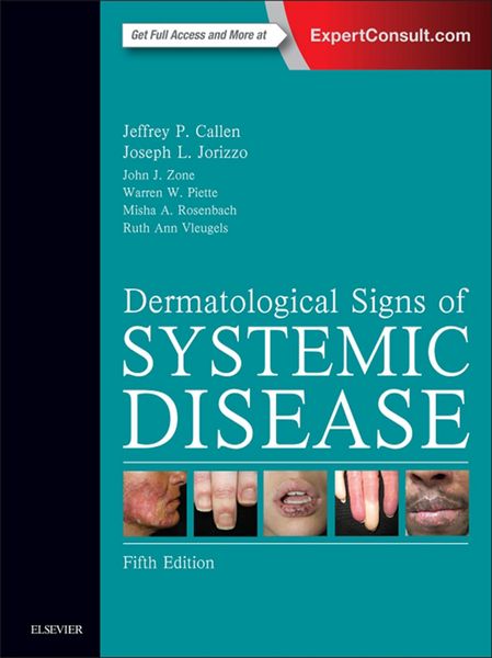 Produktbild: Dermatological Signs of Systemic Disease E-Book