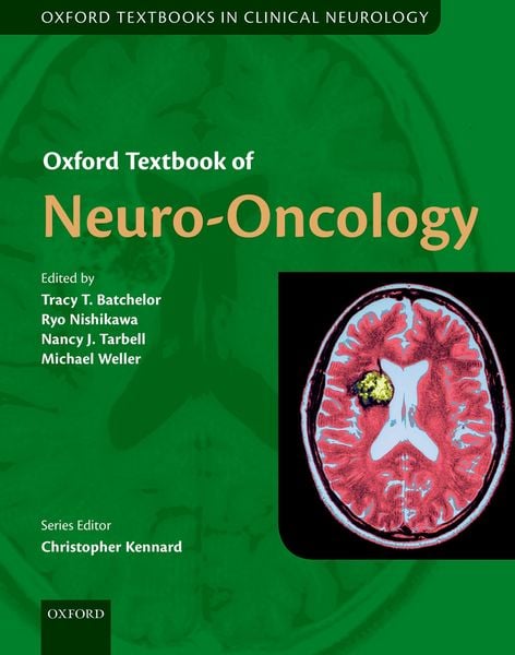 Produktbild: Oxford Textbook of Neuro-Oncology