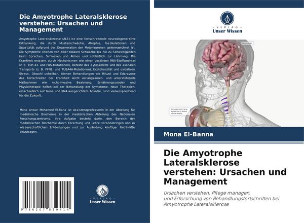 Produktbild: Die Amyotrophe Lateralsklerose verstehen: Ursachen und Management