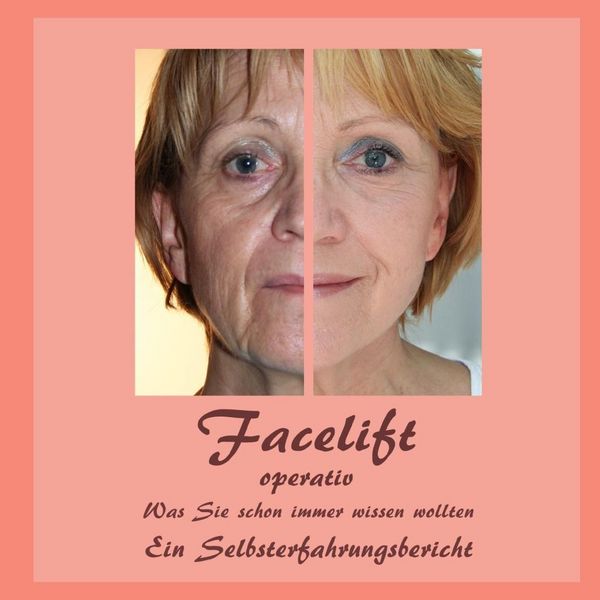 Produktbild: Facelift operativ