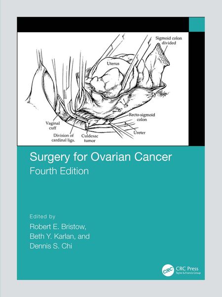 Produktbild: Surgery for Ovarian Cancer