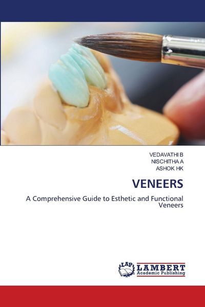 Produktbild: Veneers