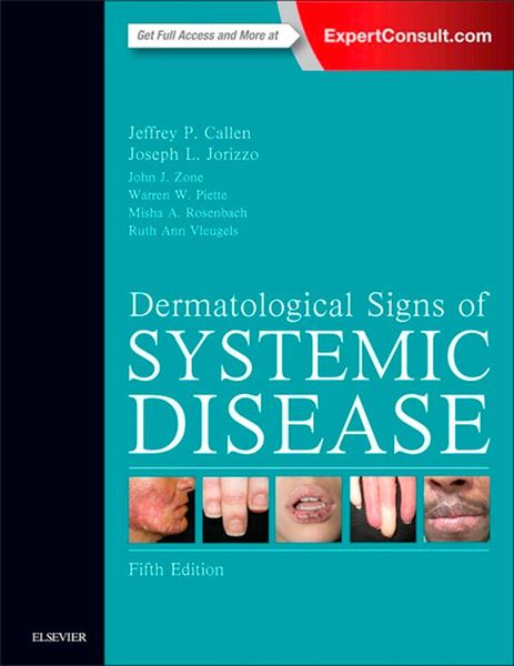 Produktbild: Dermatological Signs of Systemic Disease E-Book