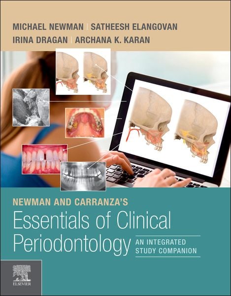 Produktbild: Newman and Carranza's Essentials of Clinical Periodontology E-Book