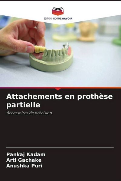 Produktbild: Attachements en proth&egrave;se partielle