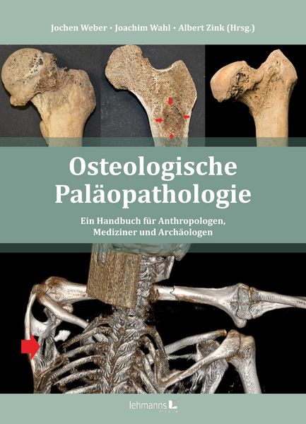 Produktbild: Osteologische Pal&auml;opathologie