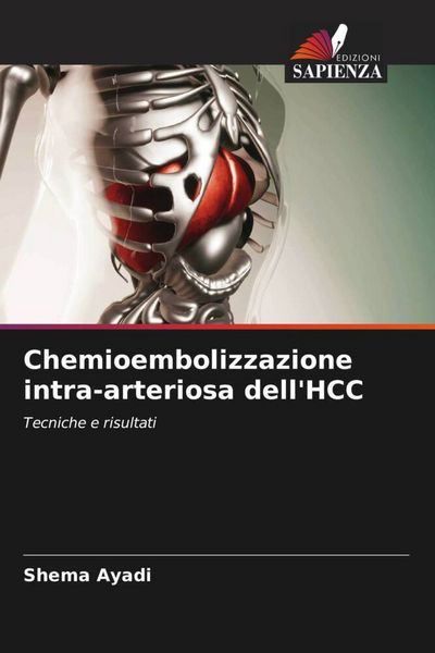 Produktbild: Chemioembolizzazione intra-arteriosa dell'HCC