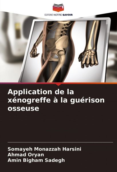 Produktbild: Application de la x&eacute;nogreffe &agrave; la gu&eacute;rison osseuse