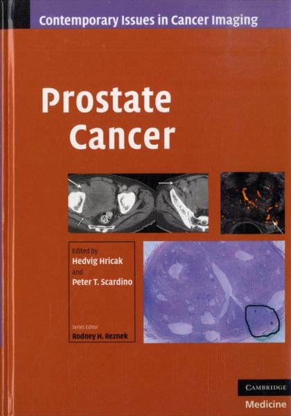 Produktbild: Prostate Cancer
