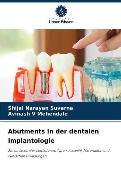 Produktbild: Abutments in der dentalen Implantologie