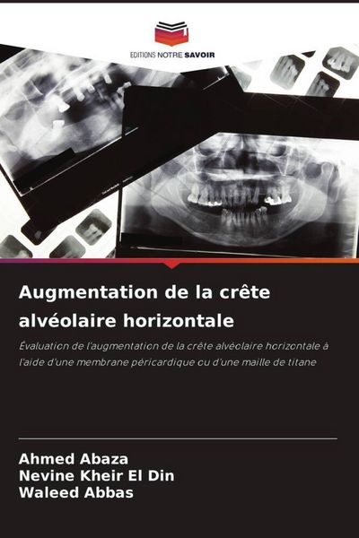 Produktbild: Augmentation de la cr&ecirc;te alv&eacute;olaire horizontale