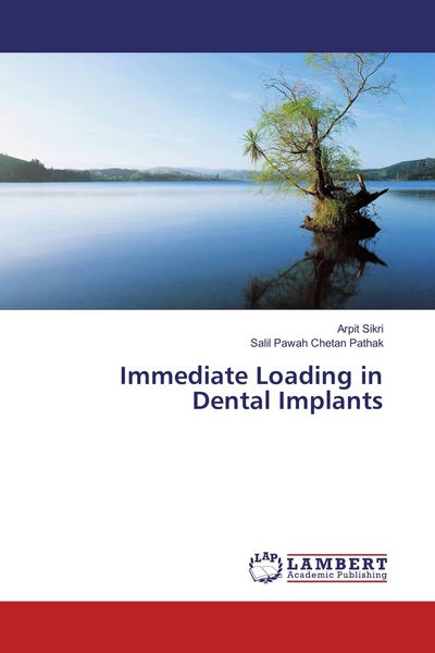 Produktbild: Immediate Loading in Dental Implants