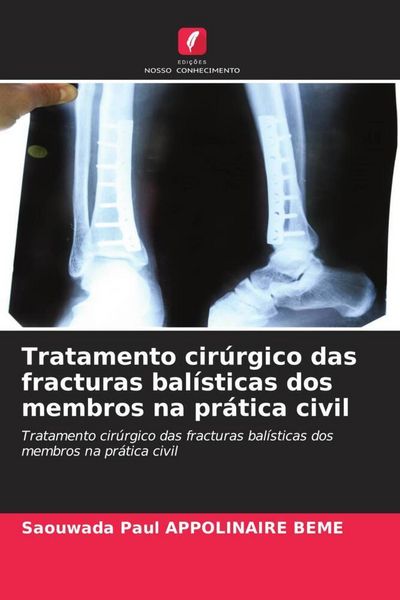 Produktbild: Tratamento cir&uacute;rgico das fracturas bal&iacute;sticas dos membros na pr&aacute;tica civil