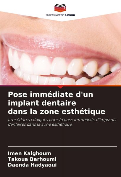 Produktbild: Pose imm&eacute;diate d'un implant dentaire dans la zone esth&eacute;tique