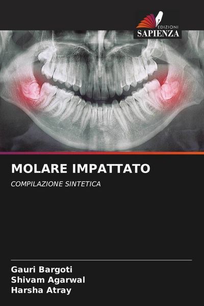 Produktbild: Molare Impattato