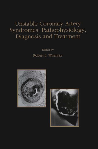 Produktbild: Unstable Coronary Artery Syndromes Pathophysiology, Diagnosis and Treatment