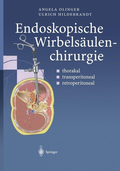 Produktbild: Endoskopische Wirbels&auml;ulenchirurgie