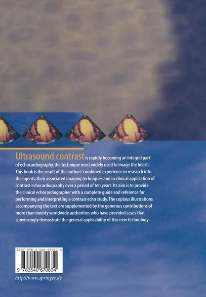 Produktbild: Handbook of Contrast Echocardiography