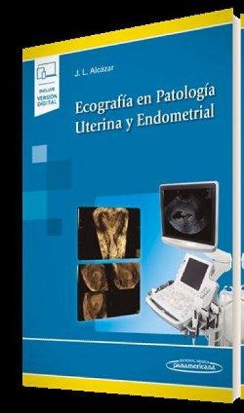 Produktbild: Ecograf&iacute;a en Patolog&iacute;a Uterina y Endometrial