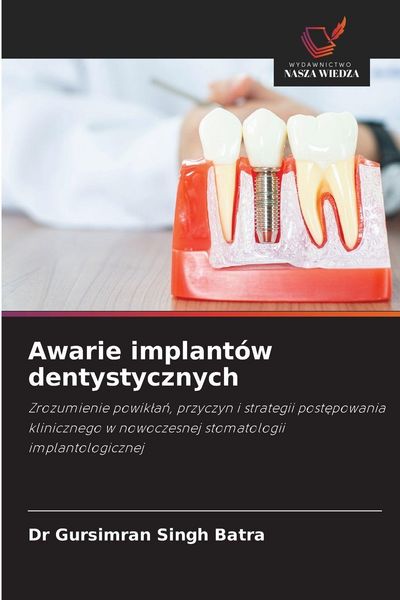 Produktbild: Awarie implant&oacute;w dentystycznych