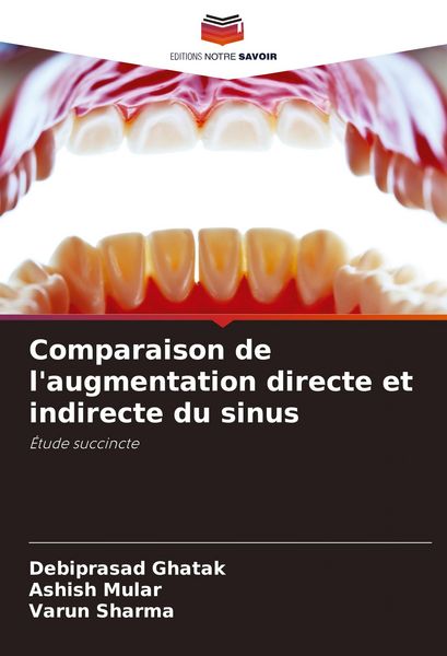 Produktbild: Comparaison de l'augmentation directe et indirecte du sinus