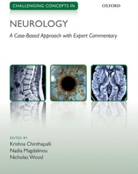 Produktbild: Challenging Concepts in Neurology